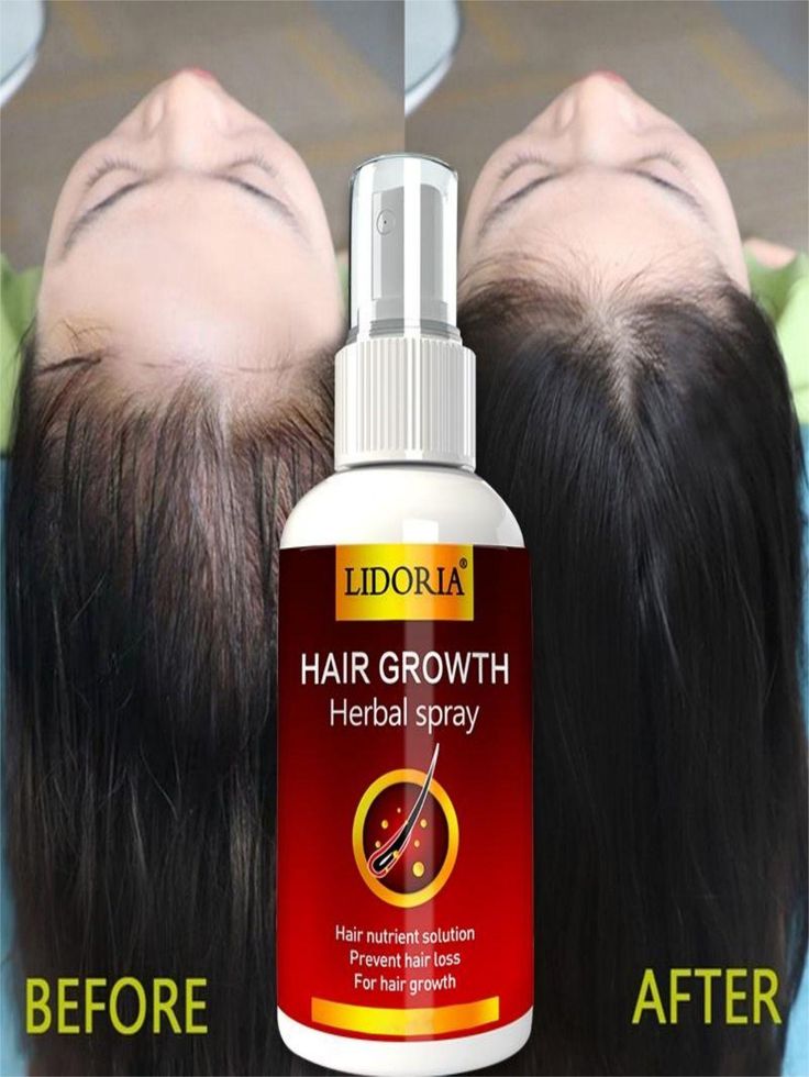 Premium Natural Hair Growth Serum & Essential Oil Collection | Organic Rosemary, Red Onion, Ginger & Ganoderma Nutrient Scalp Treatment for Anti-Hair Loss & Fast Regrowth