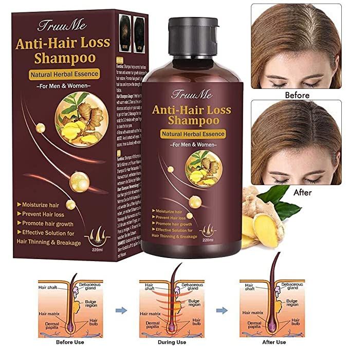Premium Anti-Hair Loss & Regrowth Shampoo Collection | Natural Herbal Essence Ginger, Coconut Anti-Dandruff & Nourishing Scalp Care Serum Treatment