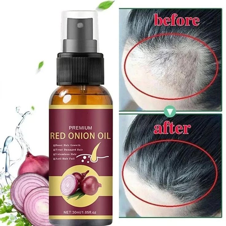 Premium Natural Hair Growth Serum & Essential Oil Collection | Organic Rosemary, Red Onion, Ginger & Ganoderma Nutrient Scalp Treatment for Anti-Hair Loss & Fast Regrowth